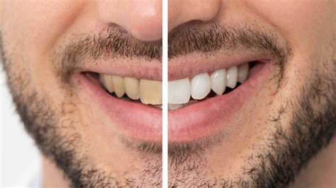 laser dentistry portland|SE Portland Laser Dentist .